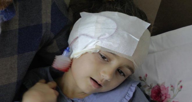 Köpek saldırısında dehşeti yaşayan çocuğun başına 300 dikiş atıldı